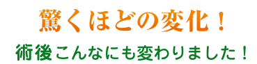 驚くほどの変化！術後こんなにも変わりました！